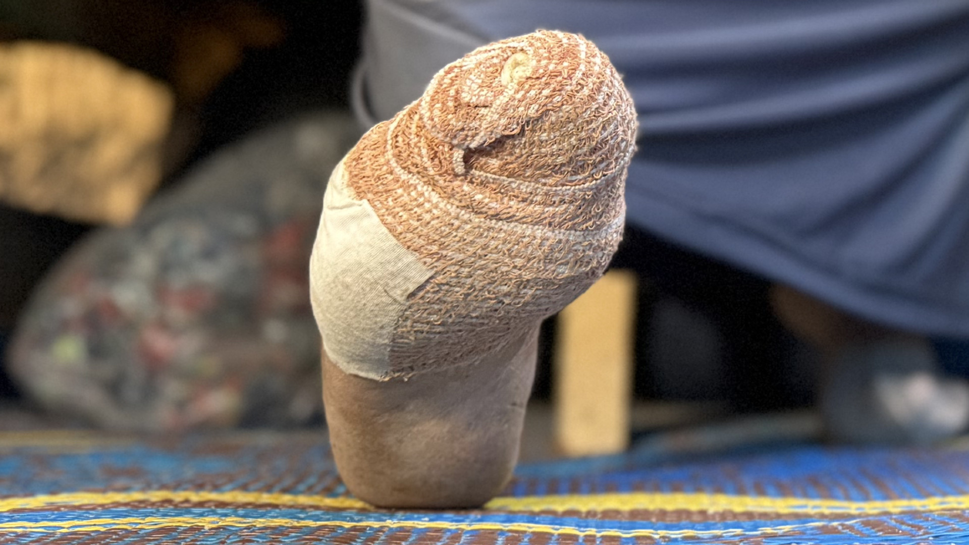 ‘The rat gnawed at my toes’: Rodent infestation overruns Gaza’s displaced